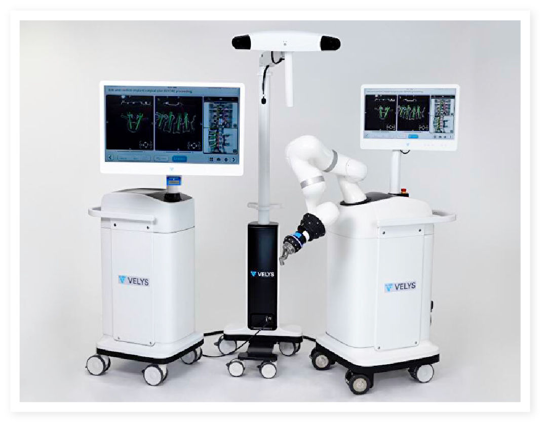 Robotic-assisted surgical system with articulated robotic arm and navigation monitors in a clinical setting.